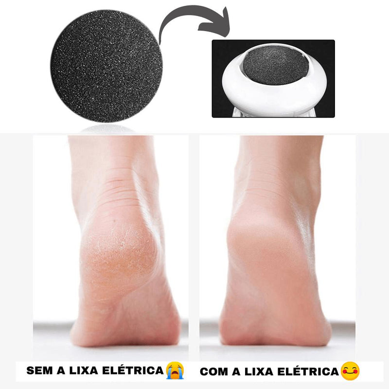 Lixa Elétrica Para Pés - Removedor de Calos